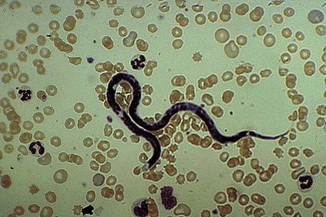 larruazalpeko parasitoaren filaria