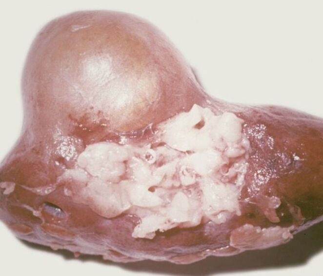 Zer dira parasitoak