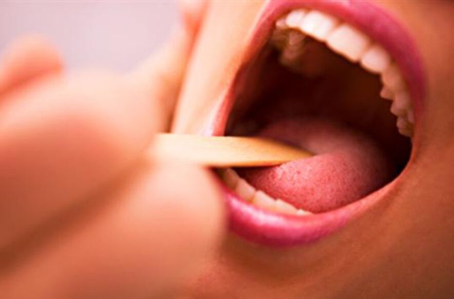 giza ahoan parasito motak